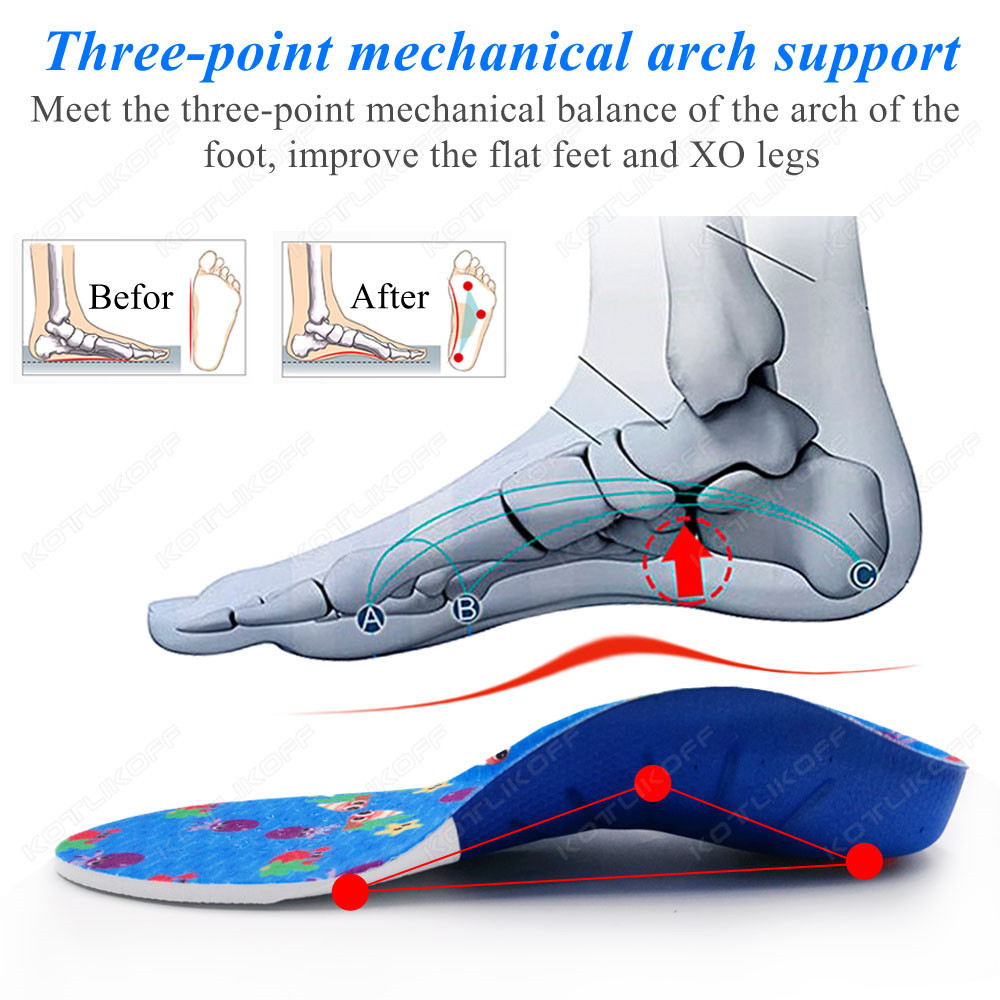 평발을위한 어린이 정형 안창 높은 아치 지원 교정 OX - Women'S Shoes High Arch Support 리뷰 및 가격