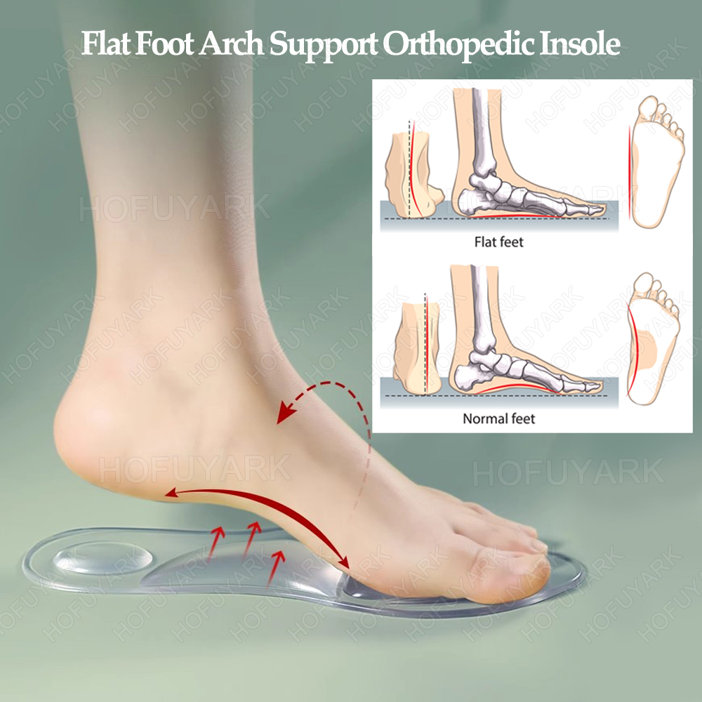 실리콘 젤 깔창 정형 외과 용 플랫 풋 아치 지원 발바 - Women'S Shoes High Arch Support 리뷰 및 가격